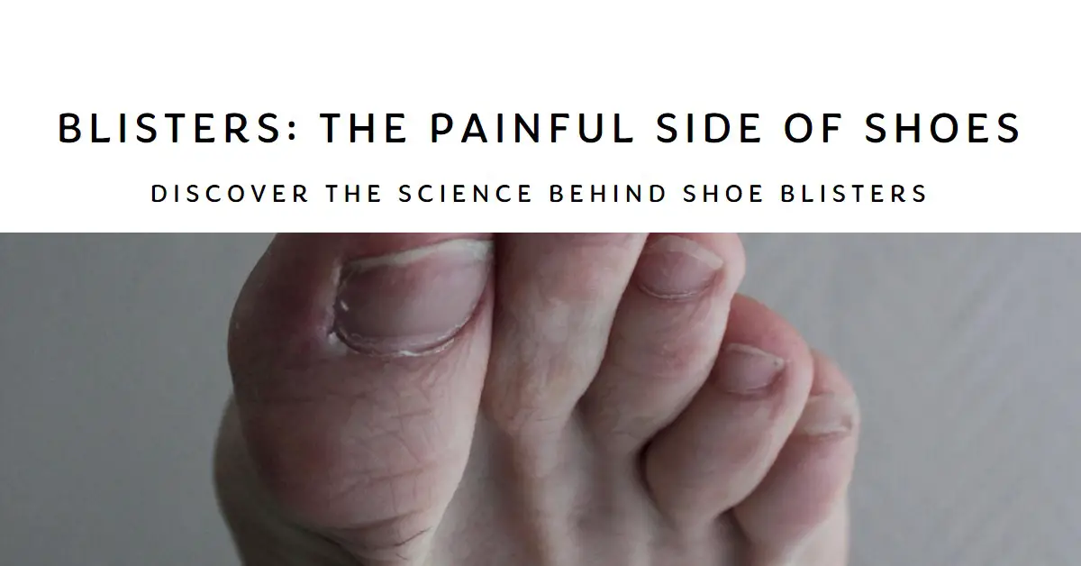 How Do Shoes Give You Blisters?